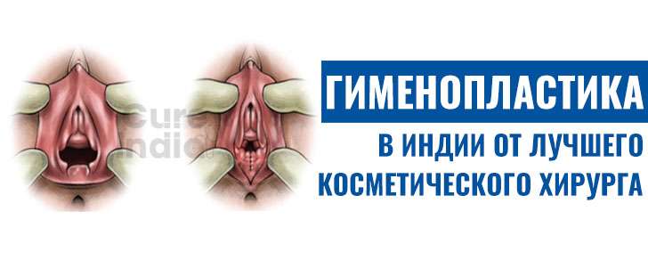 Гименопластика